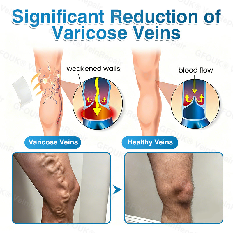 NEYEROS® VeinRepair Microneedle Patch Roll⚡Instant Relief, Long-Term Results