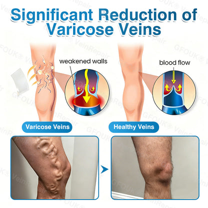 NEYEROS® VeinRepair Microneedle Patch Roll⚡Instant Relief, Long-Term Results