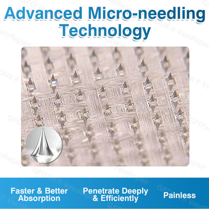 NEYEROS® VeinRepair Microneedle Patch Roll⚡Instant Relief, Long-Term Results