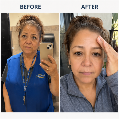 🔥Last Day-Buy 2 Get 1 Free🔥The Simple Anti-Aging Step Your Skin Has Been Missing ✨