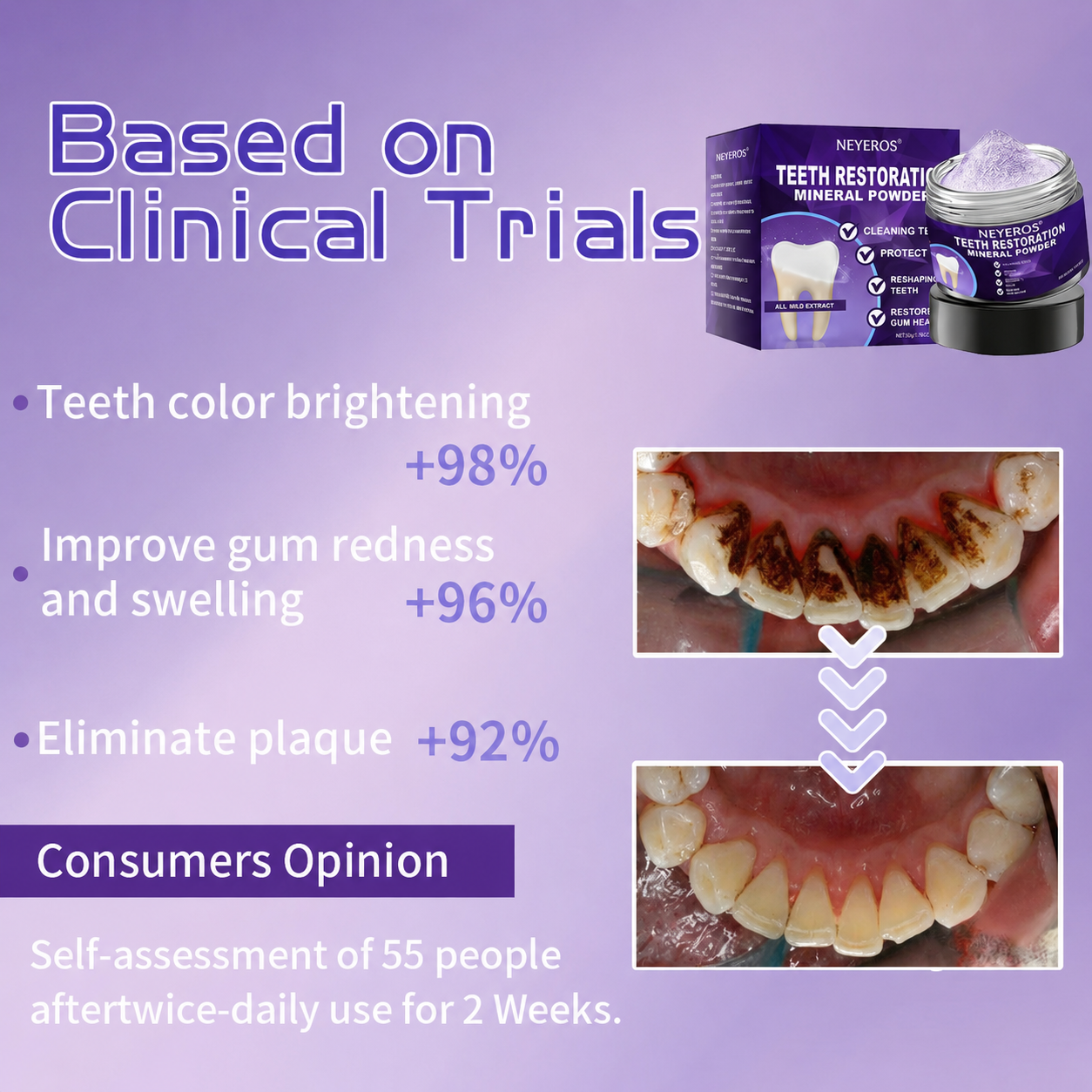 NEYEROS® 🎁Limited-Time Offer🎁 - Don't miss out! Tooth Repair Mineral Powder (Treats periodontitis and oral ulcers, prevents tooth loss, and repairs gum recession)