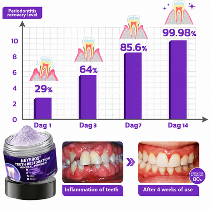 NEYEROS® 🎁Limited-Time Offer🎁 - Don't miss out! Tooth Repair Mineral Powder (Treats periodontitis and oral ulcers, prevents tooth loss, and repairs gum recession)