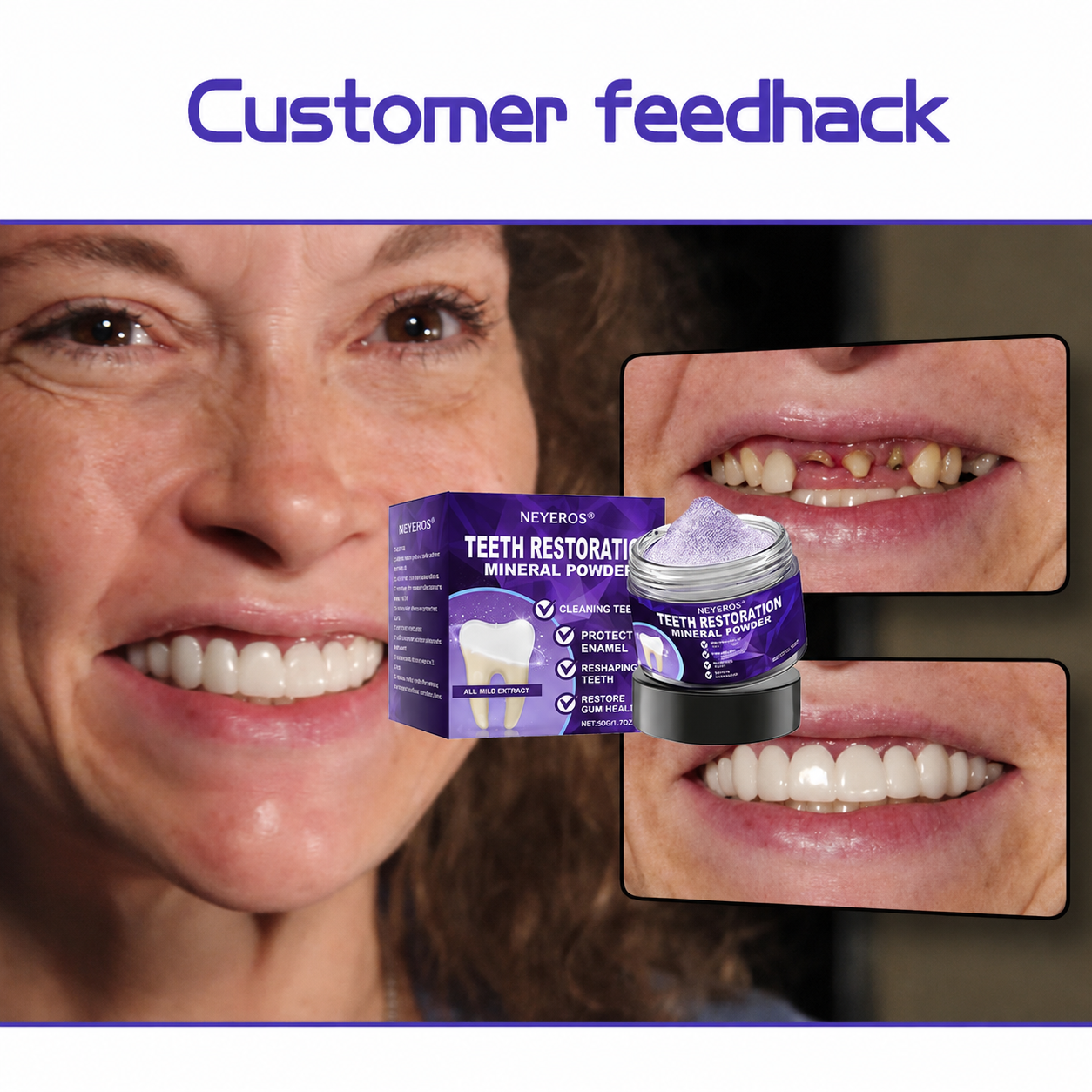 NEYEROS® 🎁Limited-Time Offer🎁 - Don't miss out! Tooth Repair Mineral Powder (Treats periodontitis and oral ulcers, prevents tooth loss, and repairs gum recession)