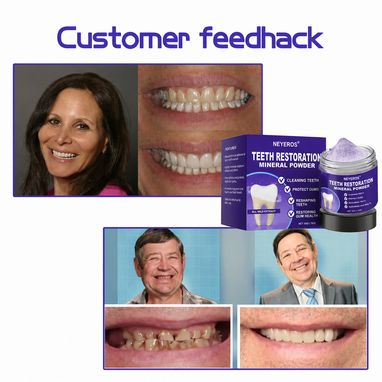 NEYEROS® 🎁Limited-Time Offer🎁 - Don't miss out! Tooth Repair Mineral Powder (Treats periodontitis and oral ulcers, prevents tooth loss, and repairs gum recession)