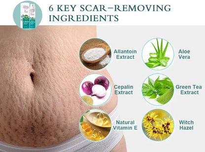 NEYEROS® SCAR SPRAY